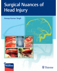 Surgical Nuances of Head Injury